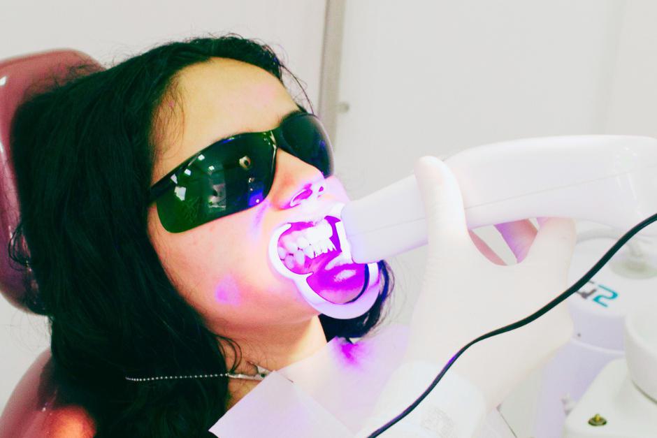 Ordinační bělení zubů