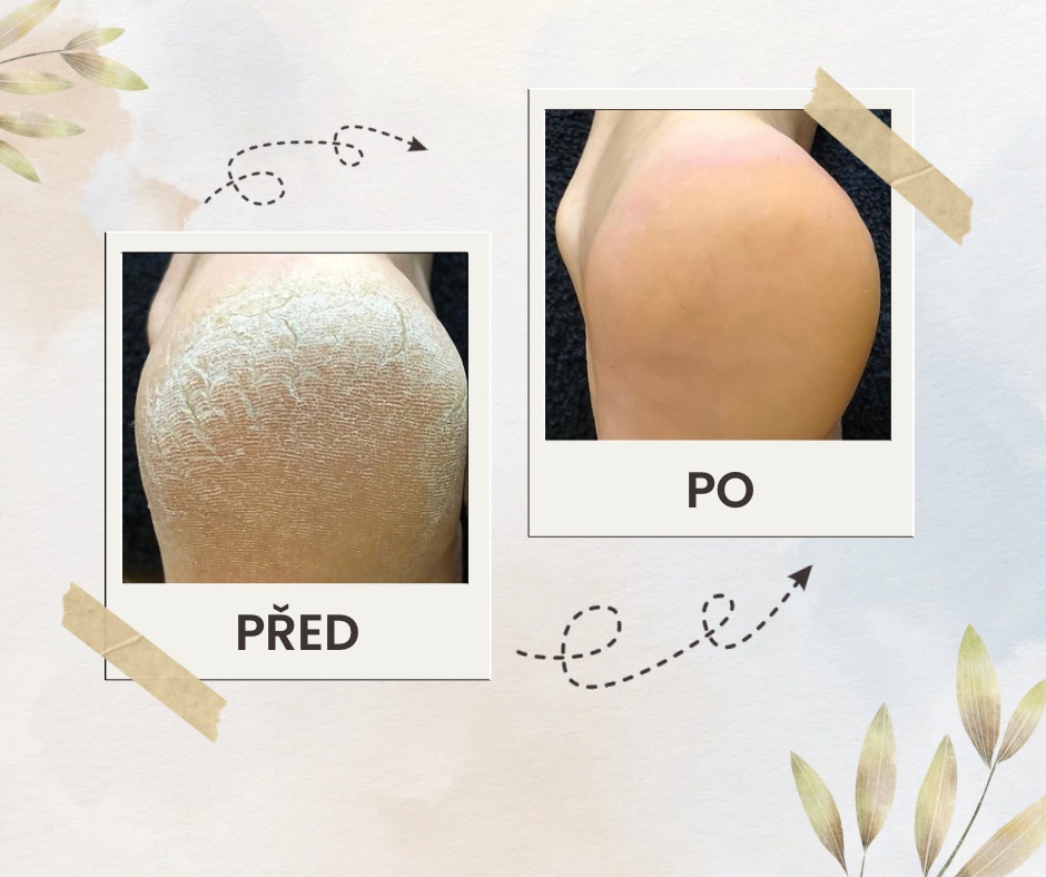 Pedikúra Jana Vocásková foto 2