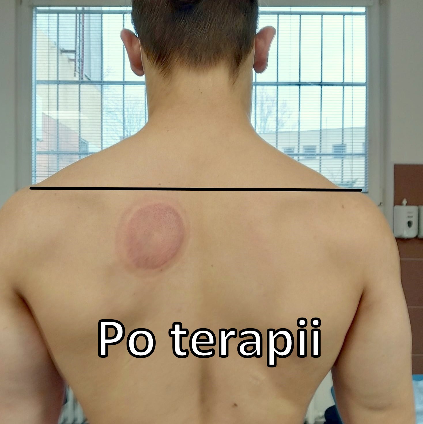 Masáže Burda foto 3