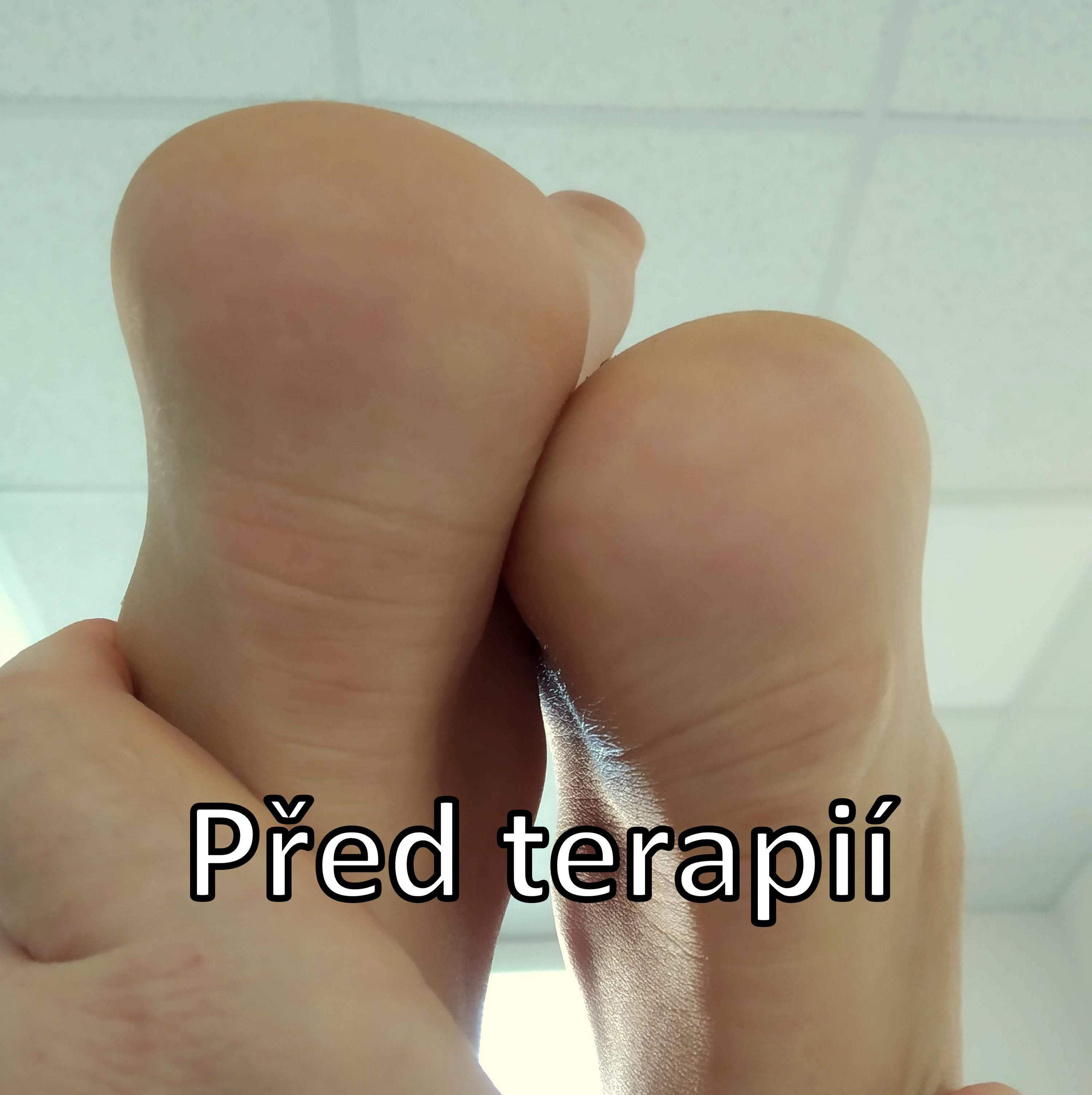 Masáže Burda foto 2