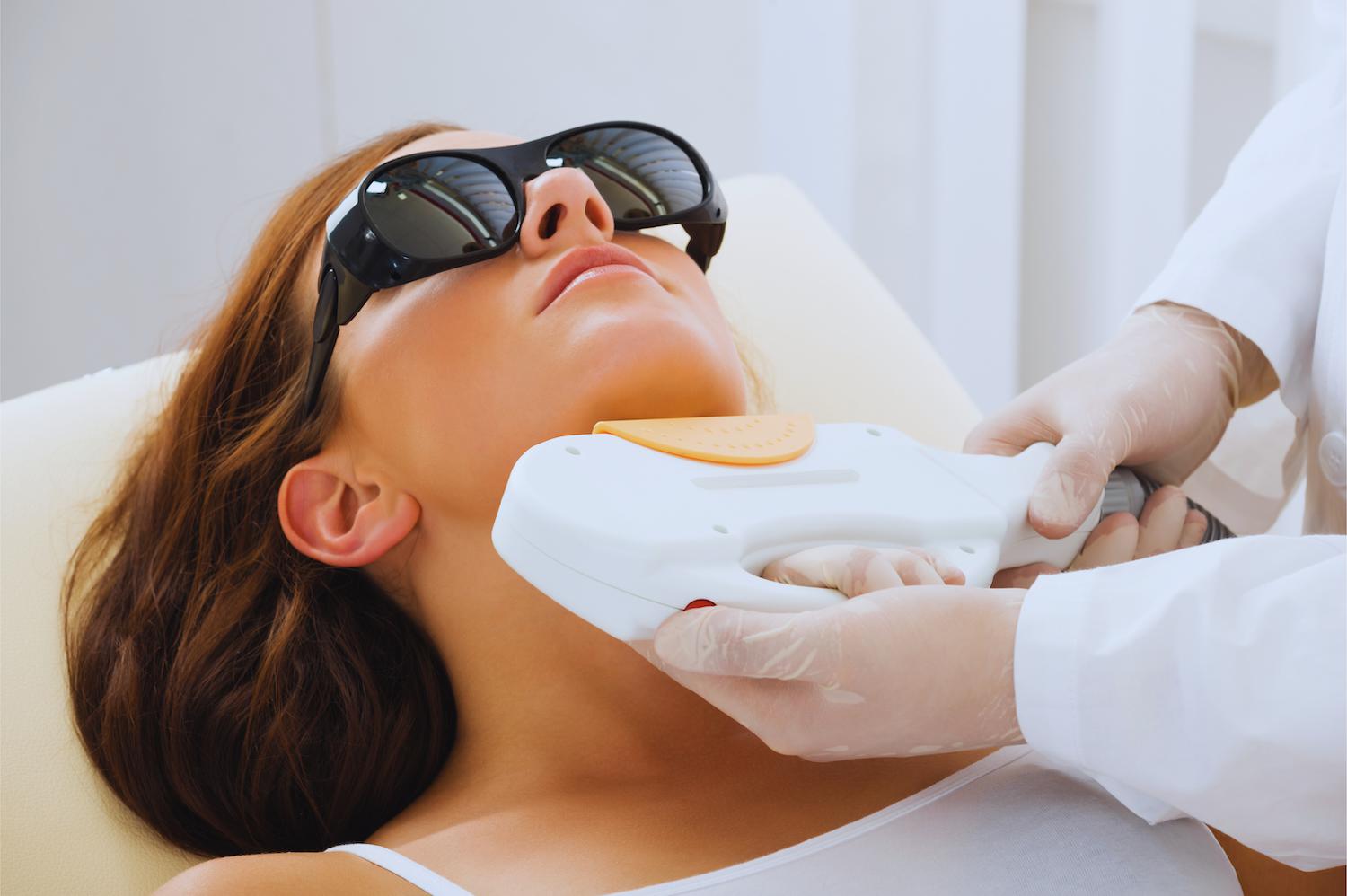 IPL ODSTRANĚNÍ ŽILEK A PIGMENTACE