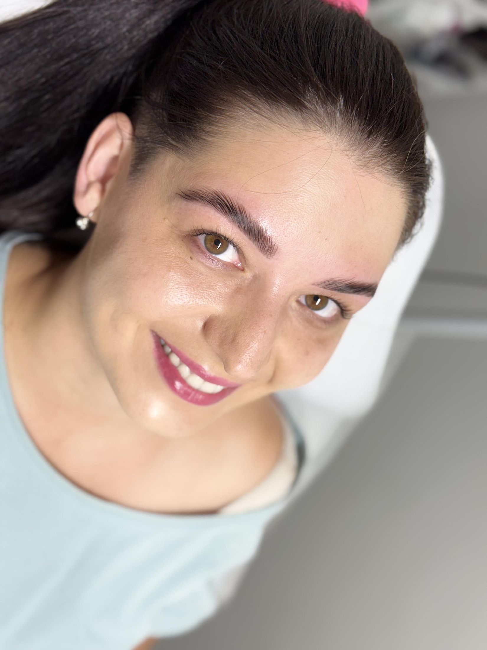 Procedura pro zbavení se akné i jizev po akné