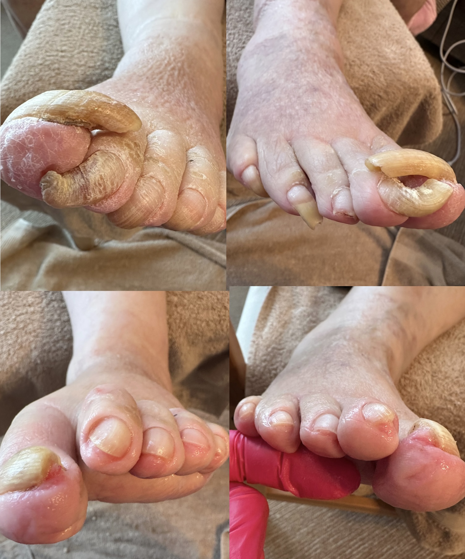 Pedikúra do domu Eva Krahulová foto 5