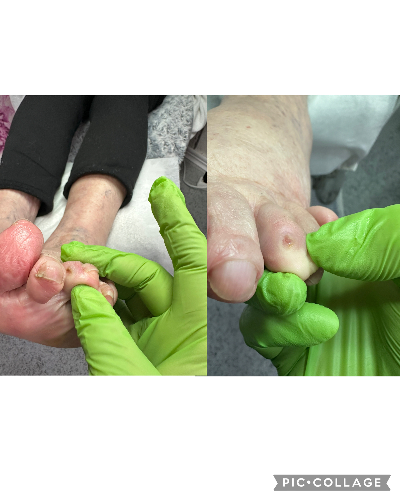 Pedikúra do domu Eva Krahulová foto 6