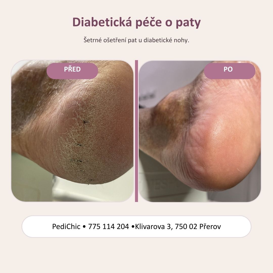 PediChic foto 4