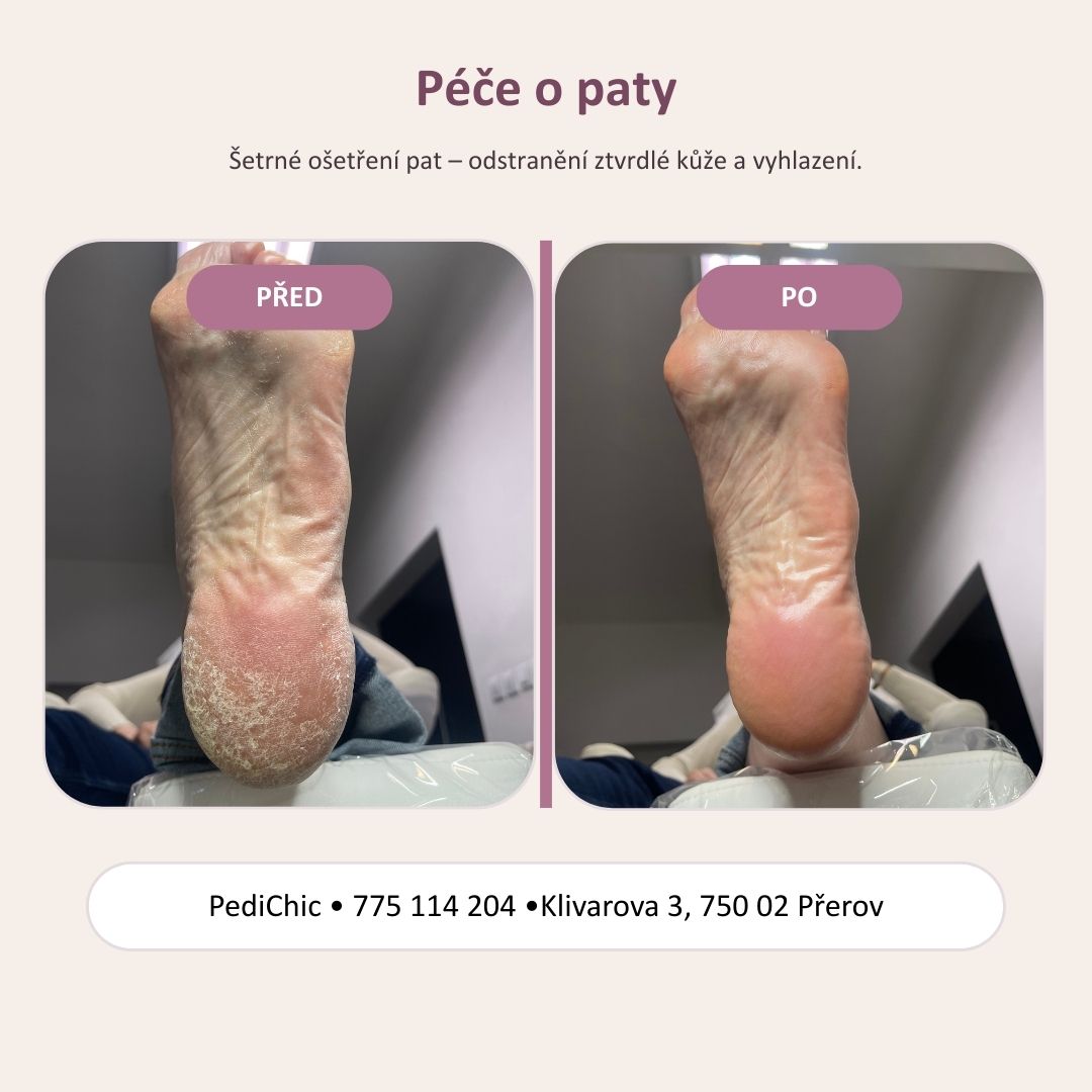 PediChic foto 5