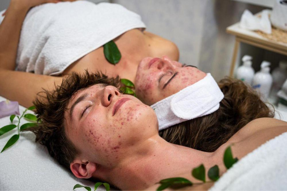 Speciální kosmetické ošetření - AKNÉ