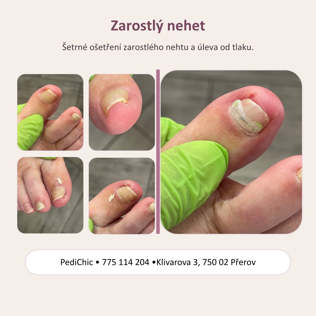 PediChic foto 3