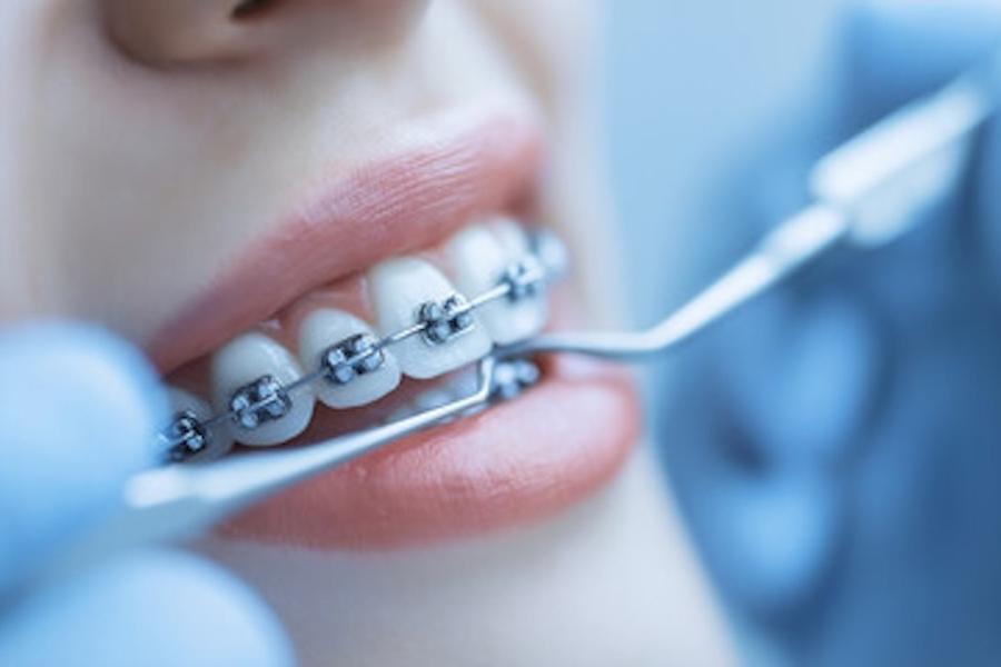 Ortodoncie Chodov – nová ordinace