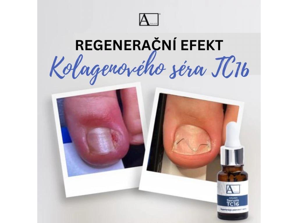 Odborná pedikúra Ivana Staňková foto 6