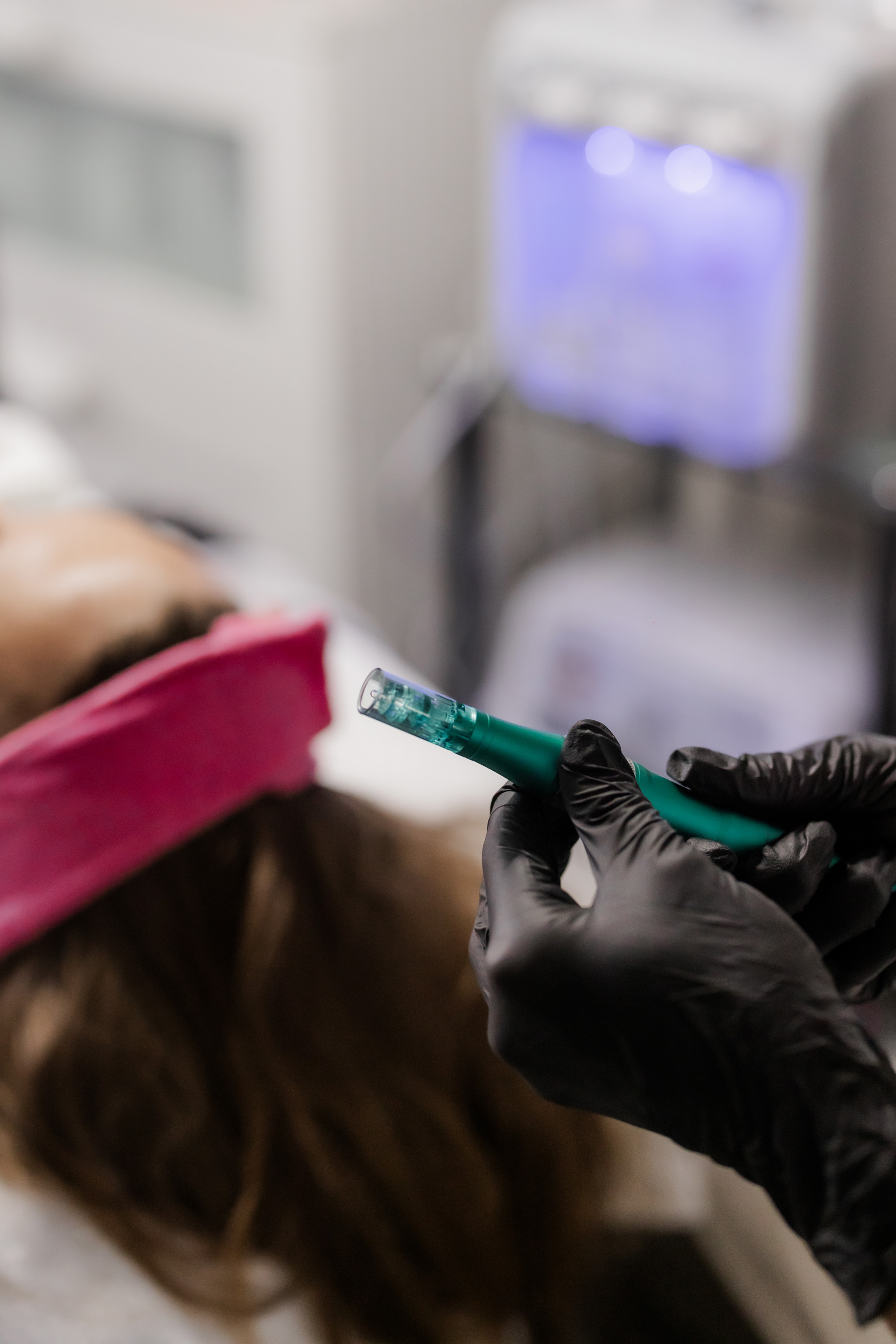 Mezoterapie / mikrojehličkování pleti