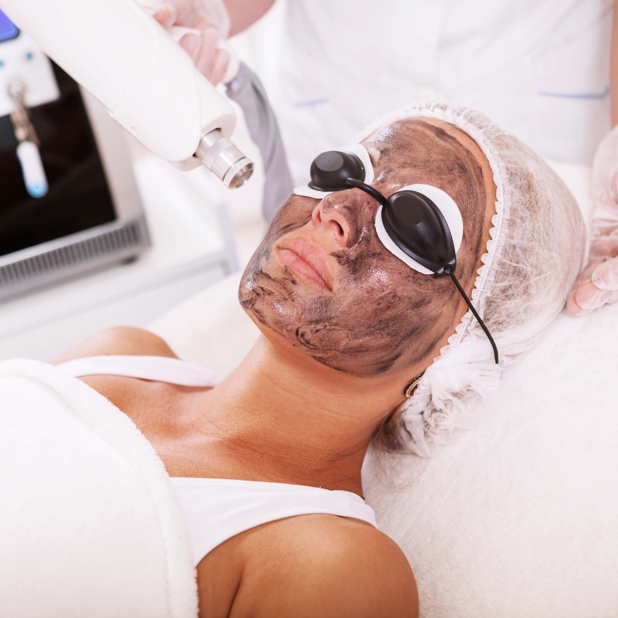 Karbonový peeling - hollywood peeling