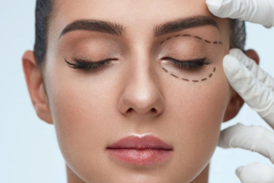 Plastická operace očních víček