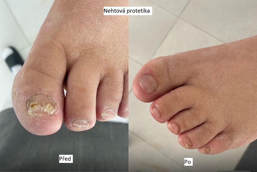 Přístrojová pedikúra Lucie foto 4