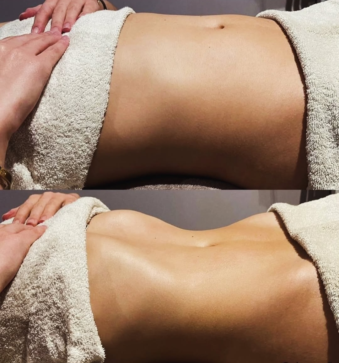 Elilien beauty - Lymfomodeling & Maderoterapie foto 5