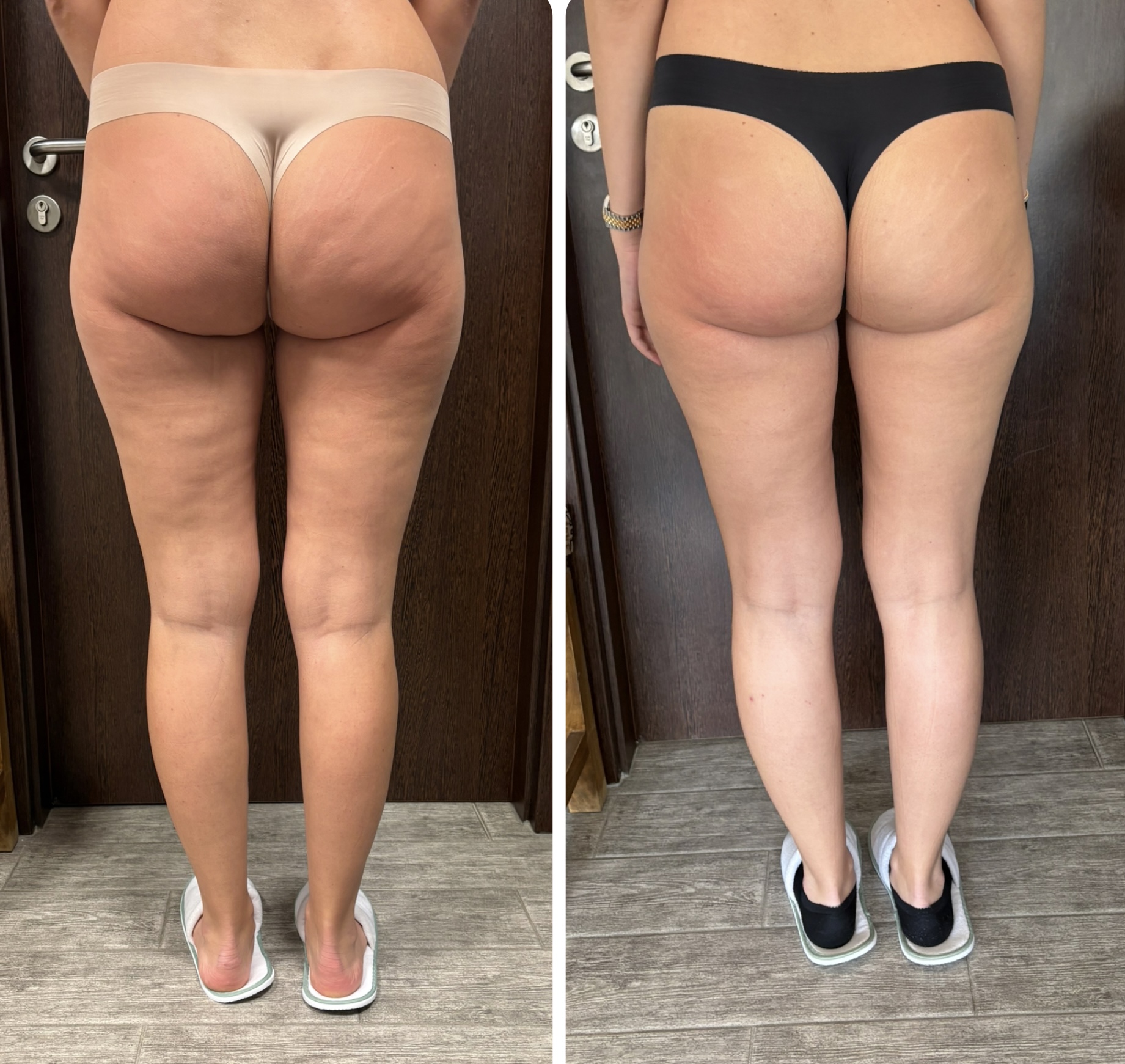 Maderoterapie Sára Timánová foto 3