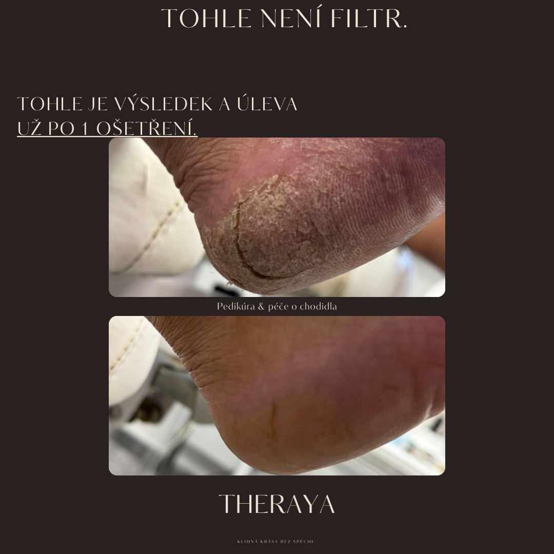 Theraya studio - pedikúra foto 2