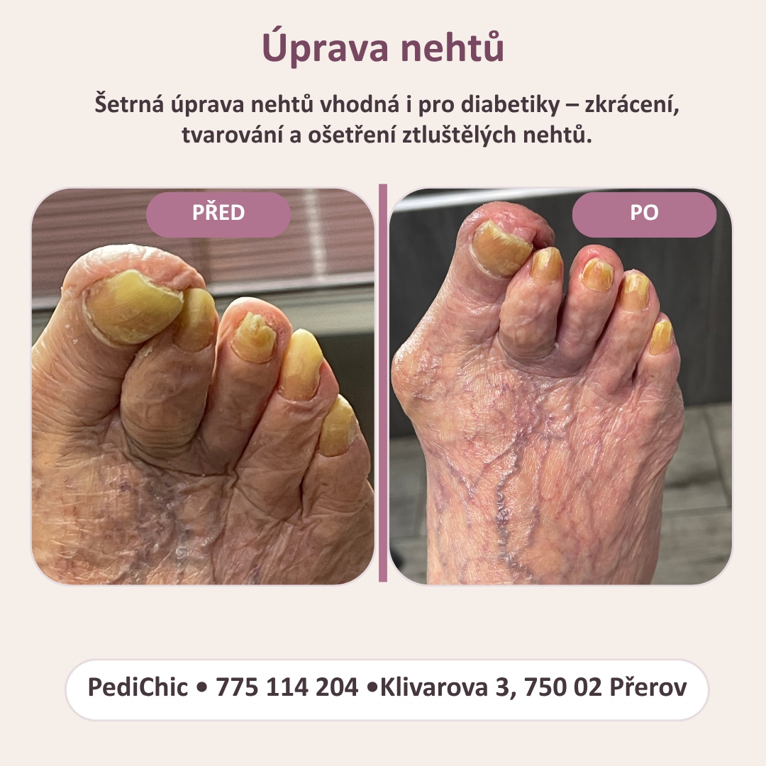 PediChic foto 4