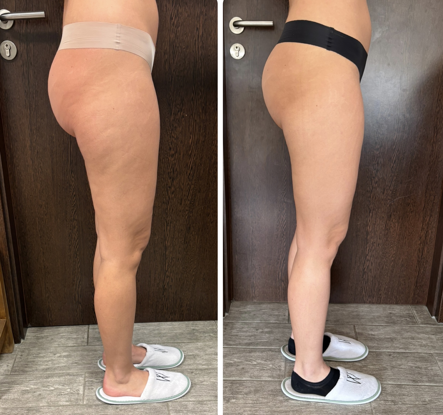 Maderoterapie Sára Timánová foto 2