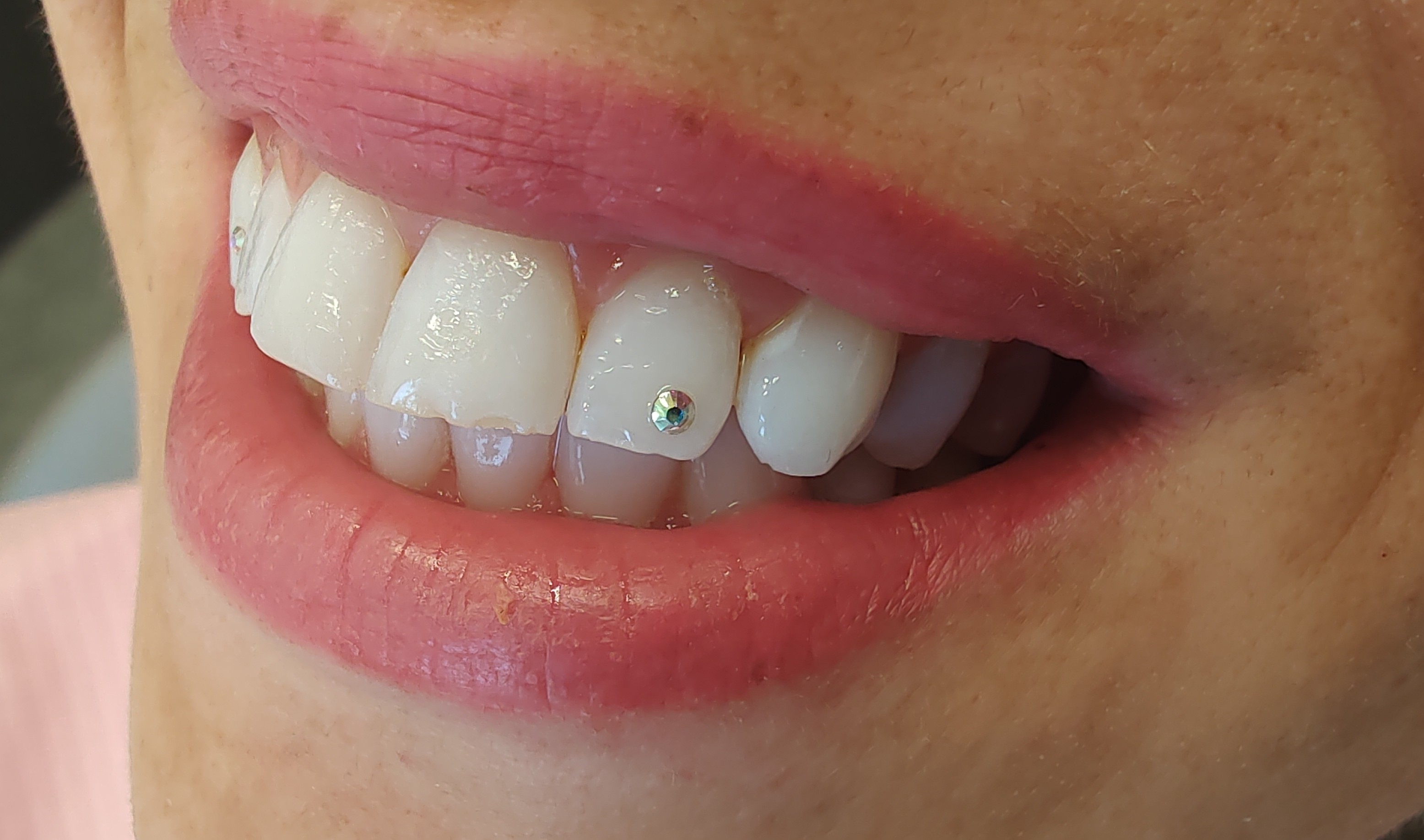 Dentální hygiena - Martina Suchá, DiS. foto 3