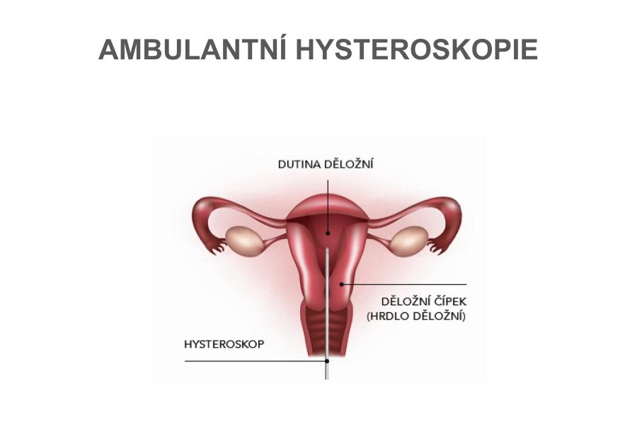 Hysteroskopie, ambulantní hysteroskopie