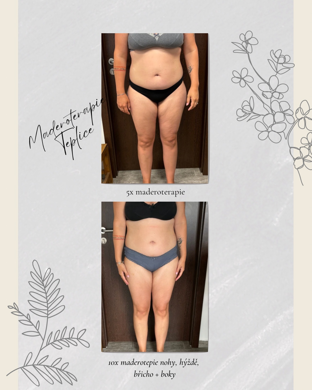 Maderoterapie Sára Timánová foto 4