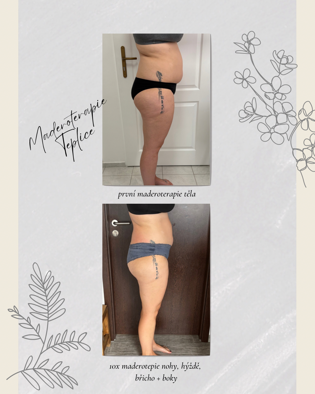 Maderoterapie Sára Timánová foto 5