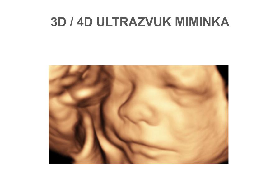 3D a 4D ultrazvu miminka
