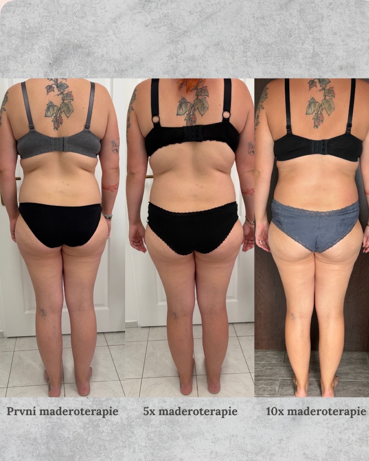 Maderoterapie Sára Timánová foto 6