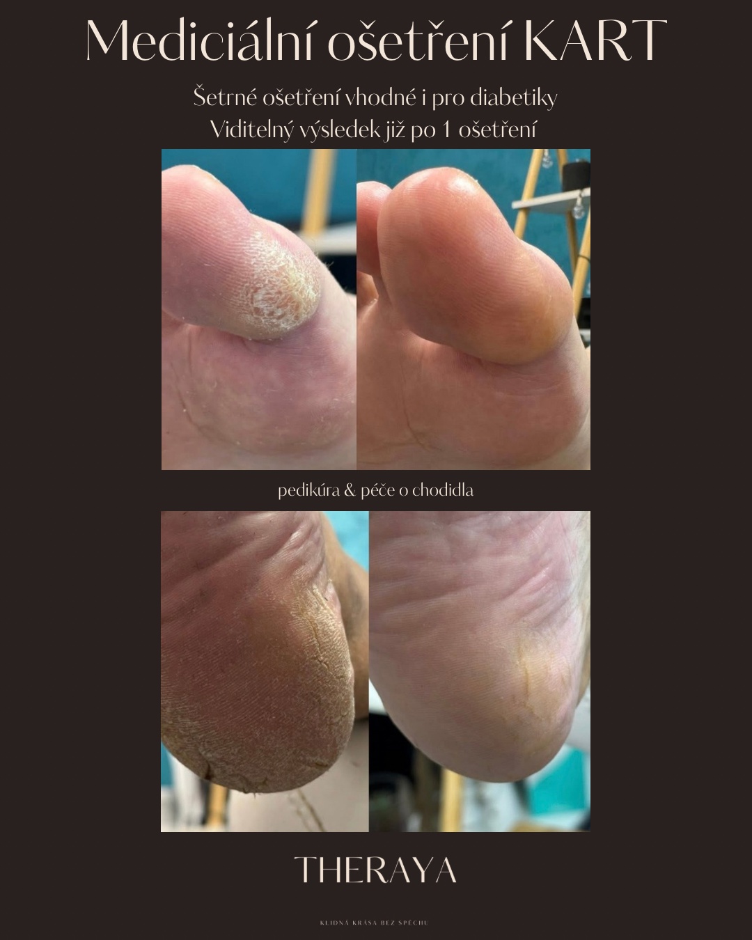 Theraya studio - pedikúra foto 3