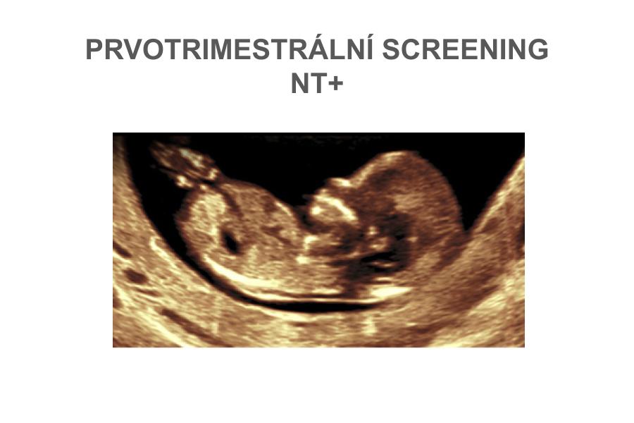 Prvotrimestrální screening - NT plus