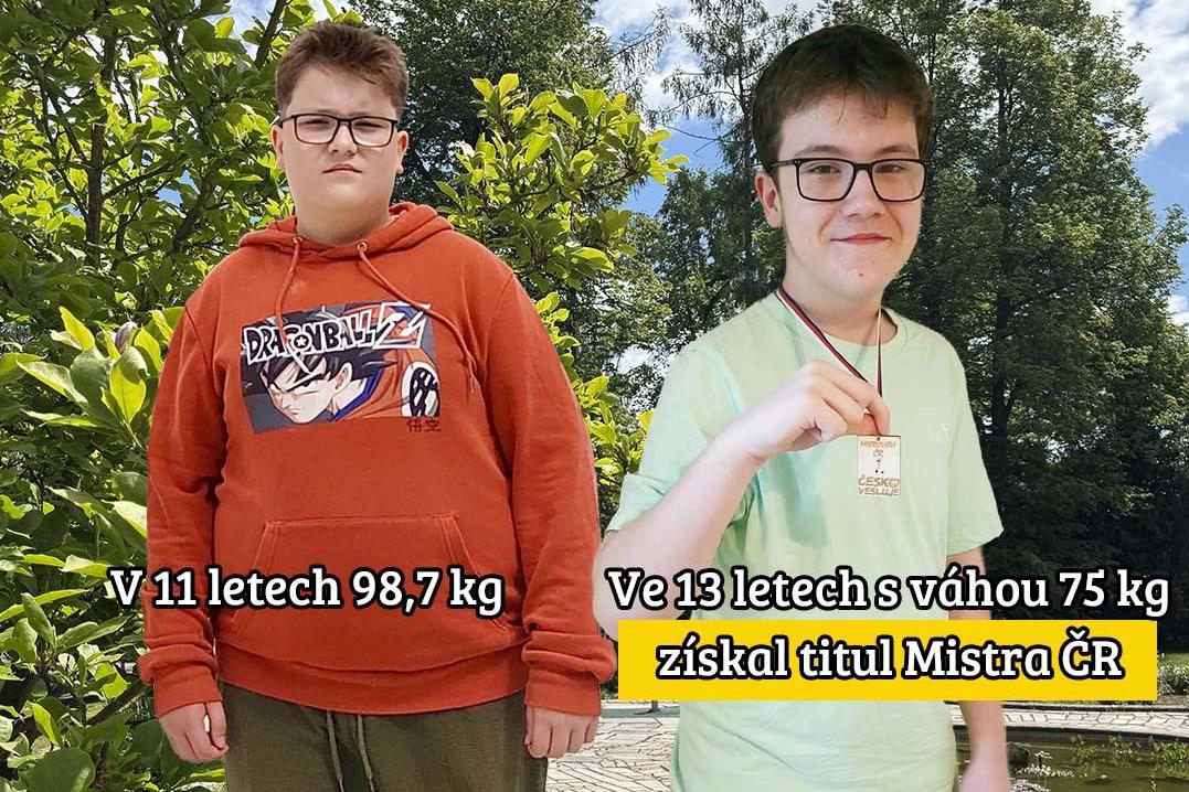 Léčba dětské obezity.