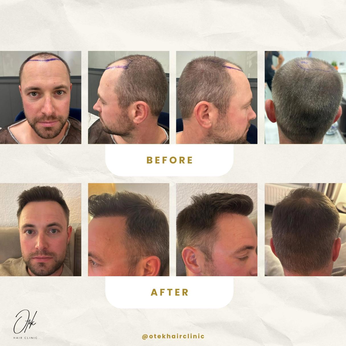 Otek Hair Clinic foto 2