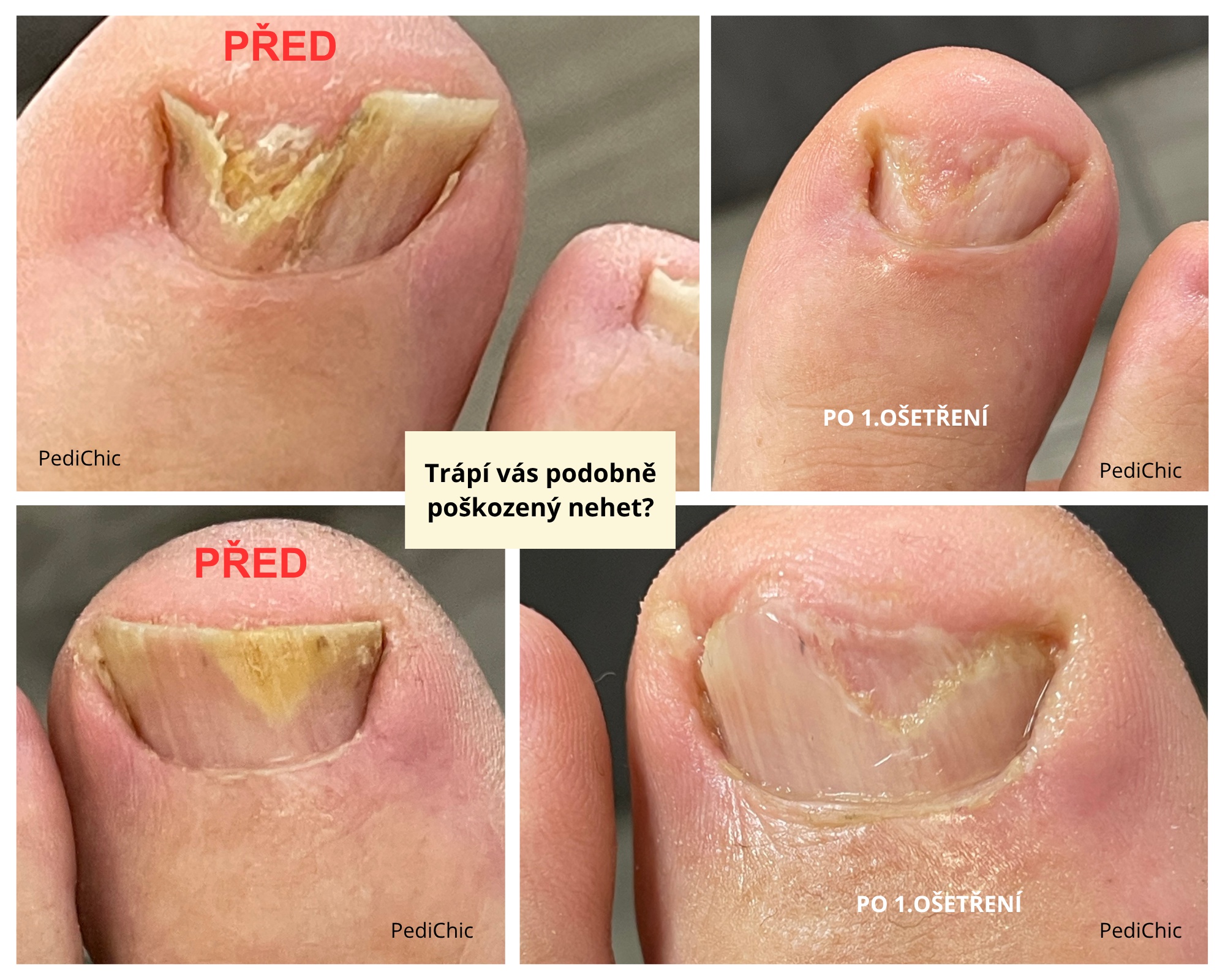 PediChic®