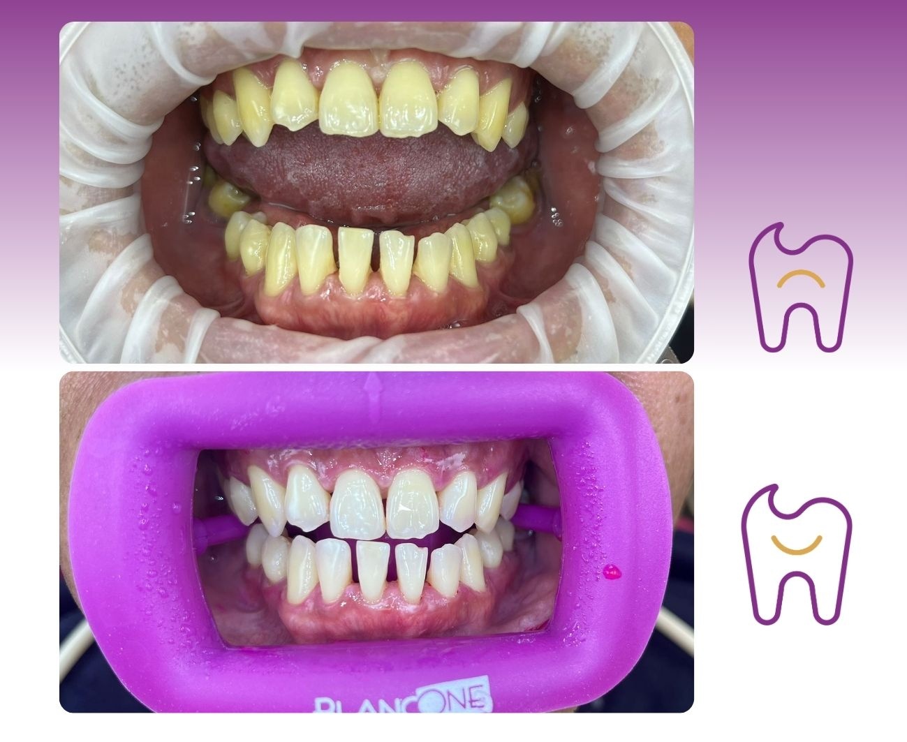 Smile Centrum Šumperka – Zubní ordinace Praha 18 foto 4