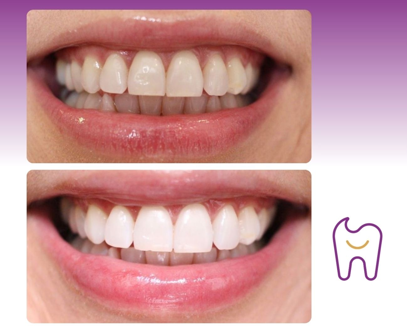 Smile Centrum Šumperka – Zubní ordinace Praha 18 foto 5