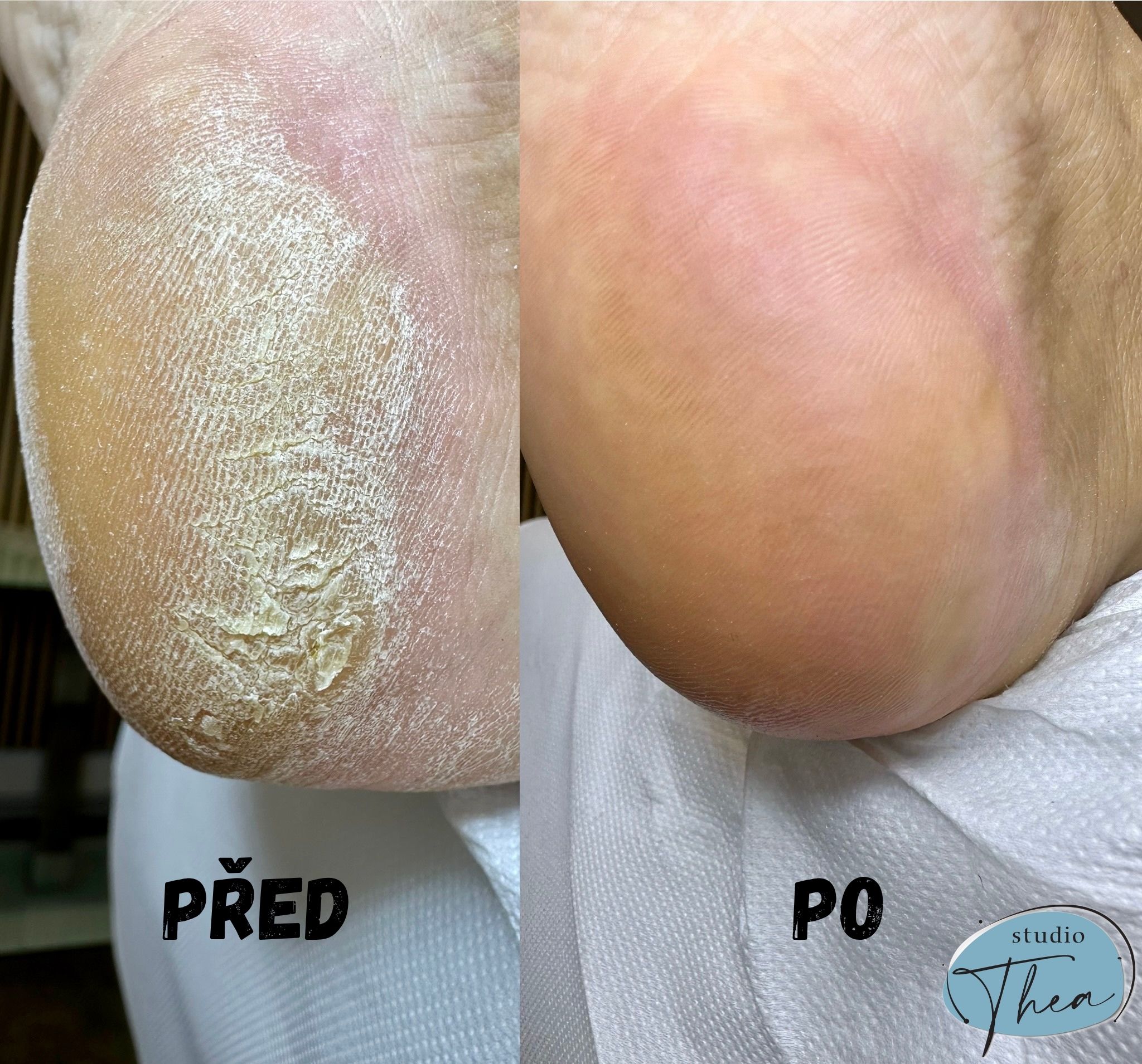 Studio Thea - Přístrojová kosmetika, manikúra, pedikúra foto 5