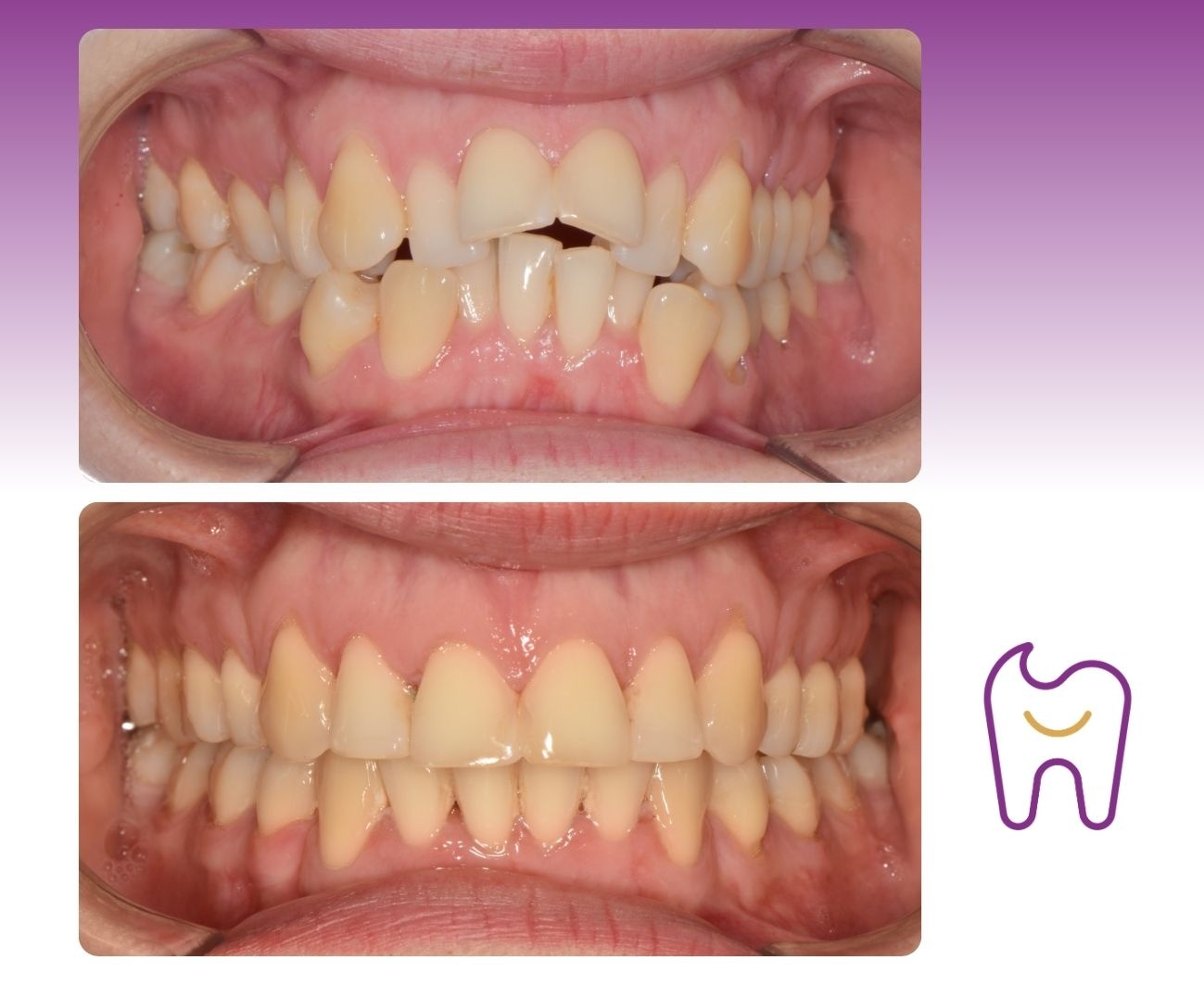 Smile Centrum Eliška – Zubní klinika Praha 9 foto 3