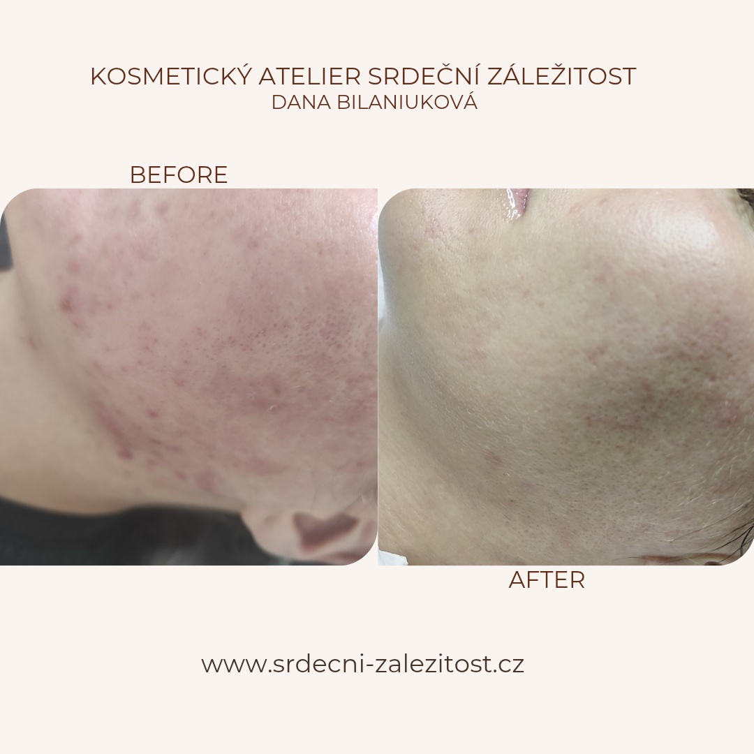 Kosmetický ateliér Srdeční záležitost - Dana Bilaniuková foto 3
