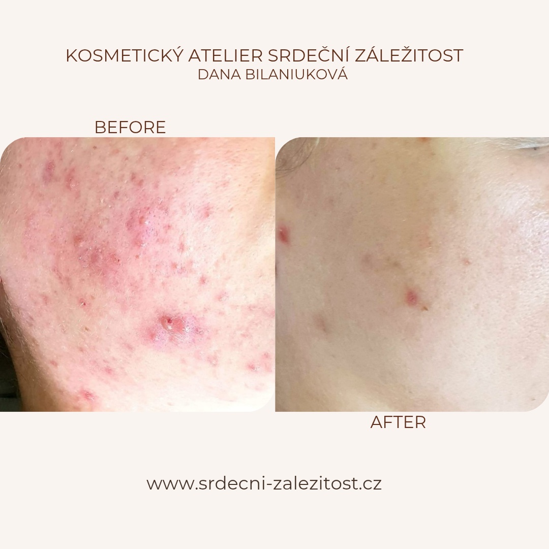 Kosmetický ateliér Srdeční záležitost - Dana Bilaniuková foto 4