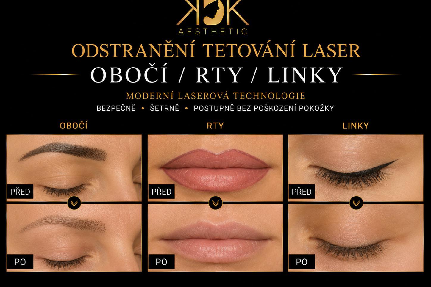 Odstranění tetování Laserem - obočí - rty - linky