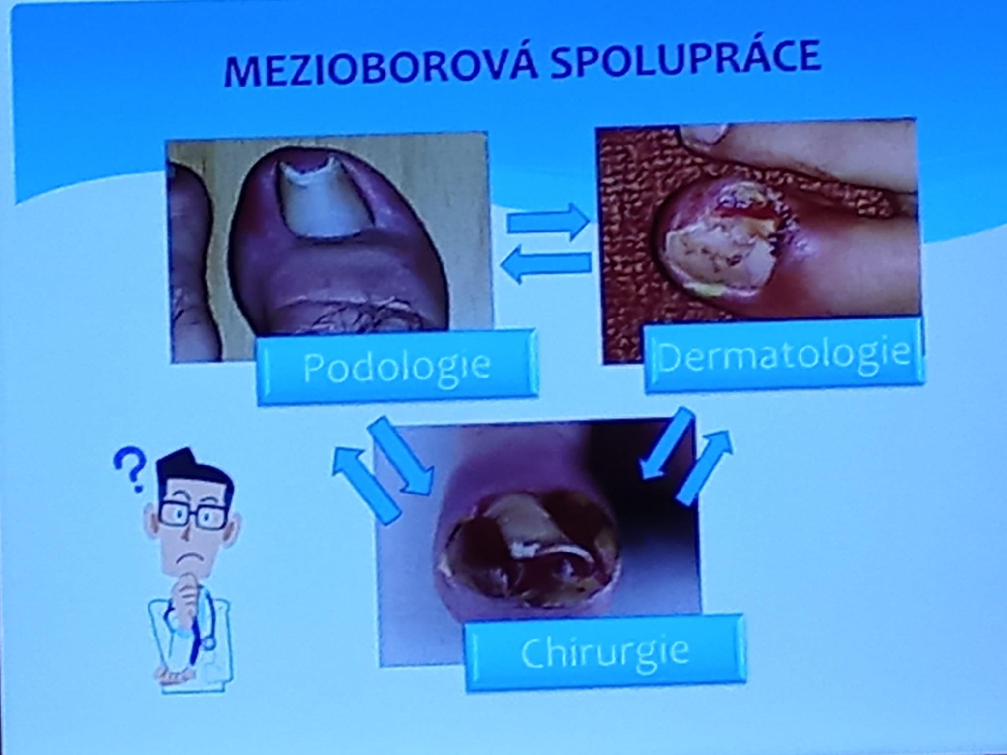 MediPed MK - Monika Kostelecká , přístrojová pedikúra, podologické služby foto 4