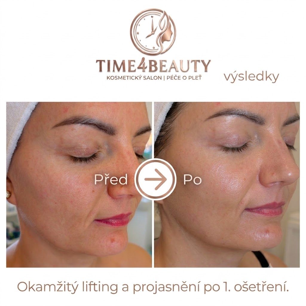 Time4Beauty | Kosmetický salon Benešov foto 4