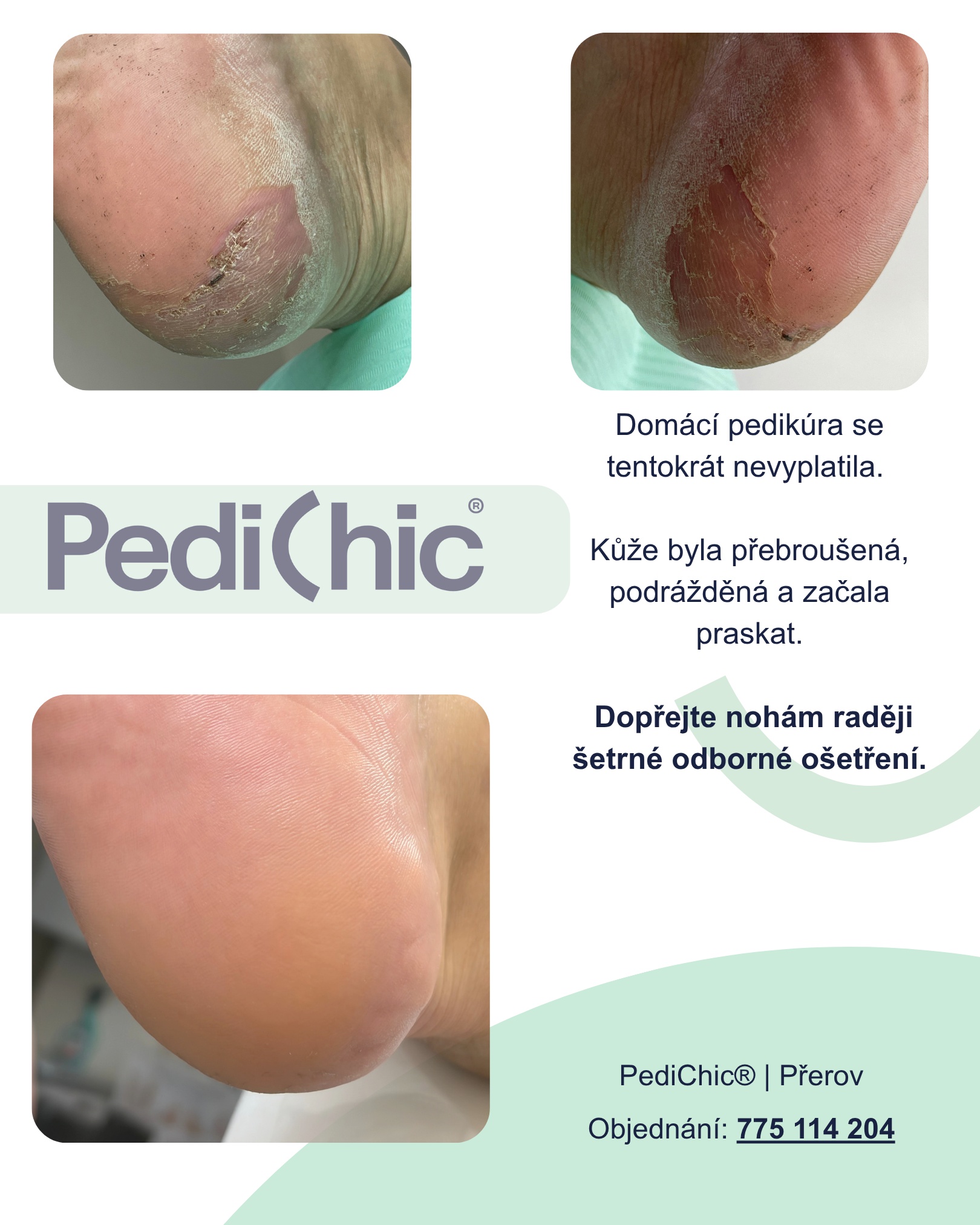 PediChic®