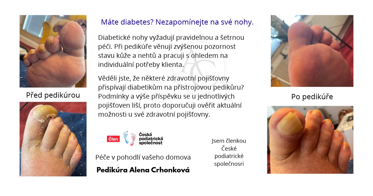 Mobilní pedikúra Alena Crhonková foto 3
