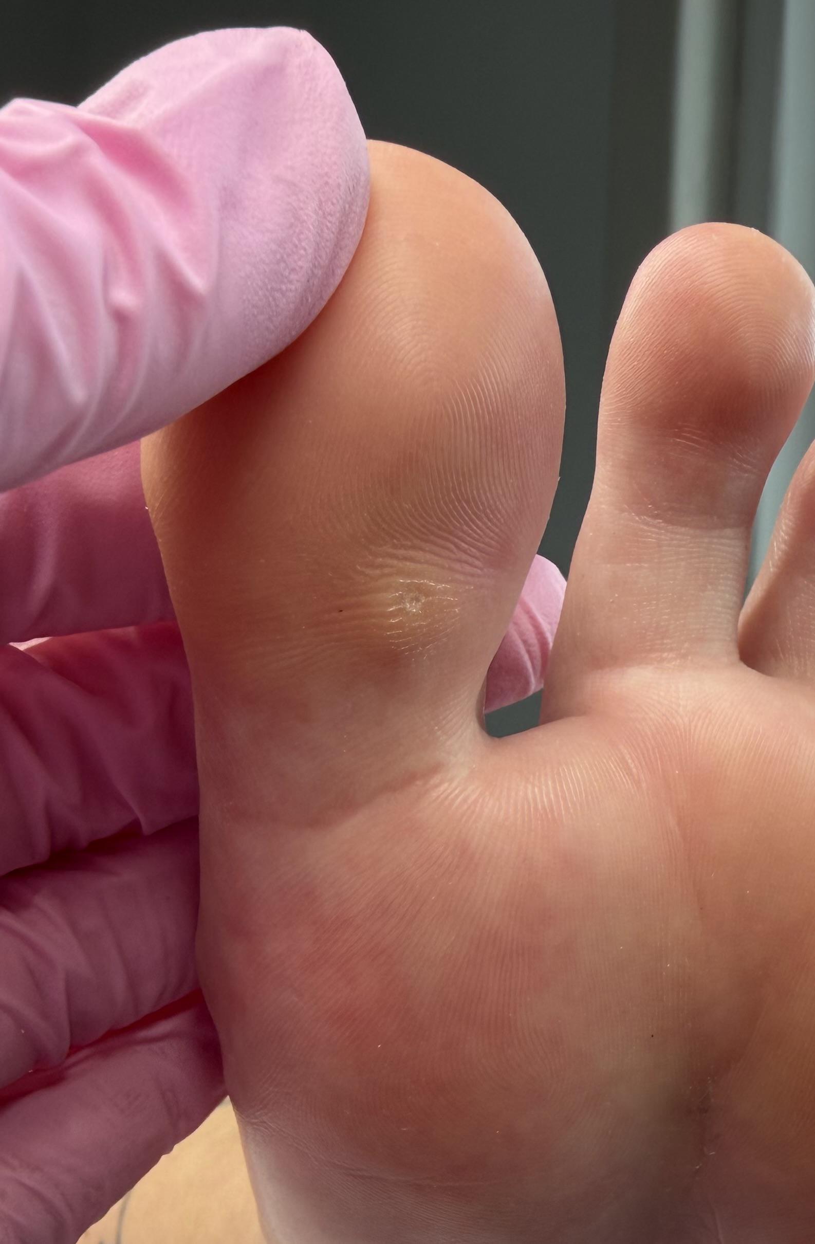 Jana přístrojová pedikúra foto 6