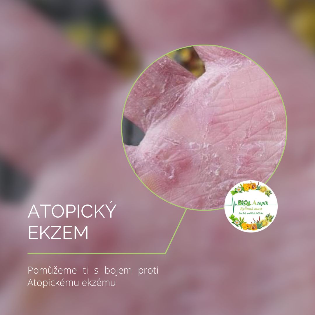 Bio Atopik foto 6